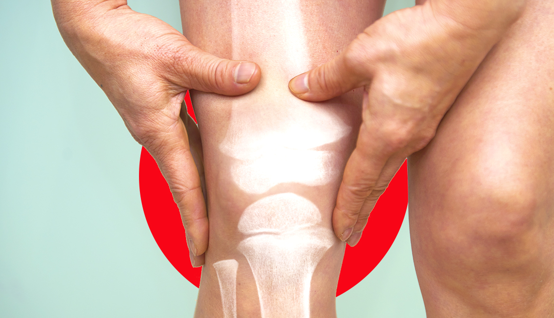 Prevenirea inflamației articulațiilor și a osteoartritei cu Bonengem